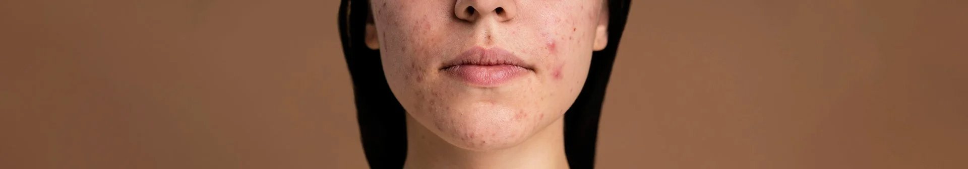 240104 garnier pickel pille header 1920x336px